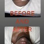 Customized Facial