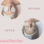 Enzyme Peel Facial