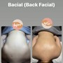 Back Facial