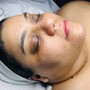 Nano Infusion Facial