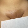 Stomach Wax + Brazilian Wax