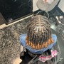 Scalp Treatment