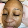 Eyelash Extension Removal