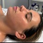 Acne Facial (Pore Detox)