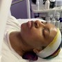 Microdermabrasion Facial (Dull/Dehydrated)