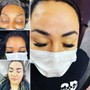 Eyelash Extension Removal