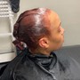 Scalp Treatment