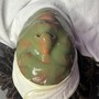 Blemish AND Balance Facial