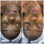 Blemish AND Balance Facial