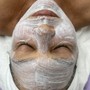 Acne facial