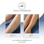 Full Arm Sugaring