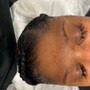 Microdermabrasion