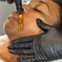 Hydrafacial Scalp Treatment