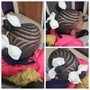 Scalp Treatment