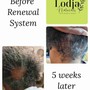 Scalp Treatment-DHT Blocker