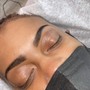 Microdermabrasion