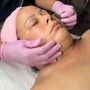 Back Facial with Microdermabrasion