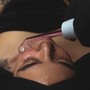 High Frequency Scalp Treatment (Facial Add Ons)