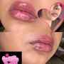 Needle Less lip Filler