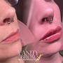 Russian Technique Lip Filler