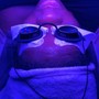 Microdermabrasion