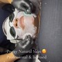 Chemical Peel