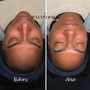 Custom Facial