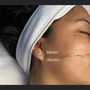 Dermalogica Chemical Peel