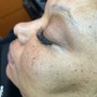 Eyelash Extension Removal