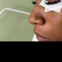 Dermaplane Facial