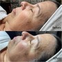 Enzymatic Facial with Steam