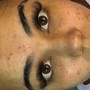 Eyelash Extension Removal