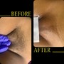 Brazilian Wax