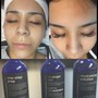 Chemical peel