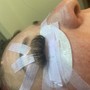 Eyelash Extension Removal