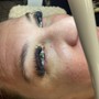 Eyelash Extension Removal