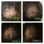 Clarifying/ Scalp Treatment