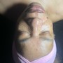 Teen Facial