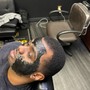 Fiber/Spray Added to Hairline/ Fill in spot