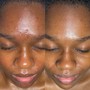 Custom Facial