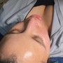 Dermaplaning Facial