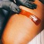 Bikini Sugaring