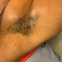 Men’s Brazilian Wax