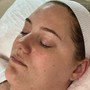 Hydrojelly Facial with LED Therapy