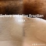 Men’s Brazilian Wax