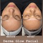 Derma Glow Facial