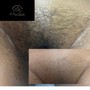 Brazilian Wax