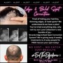 Hair Loss Correction - DIY