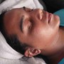 Microdermabrasion