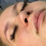 Eyelash Extension Removal